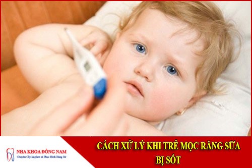 cách xử lý khi trẻ mọc răng sữa bị sốt