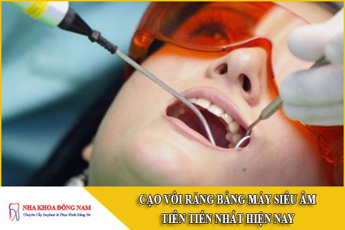 cạo vôi răng bằng máy siêu âm tiên tiến nhất hiện nay