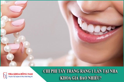 chi phí tẩy trắng răng 1 lần tại nha khoa giá bao nhiêu