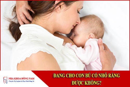đang cho con bú có nhổ răng được không