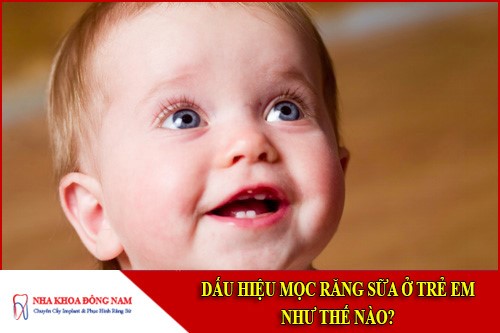 dấu hiệu mọc răng sữa ở trẻ em như thế nào