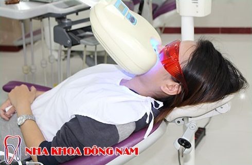 tẩy trắng răng an toàn tại nha khoa