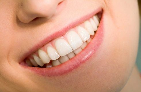 Một hàm răng đẹp dựa trên các yếu tố nào