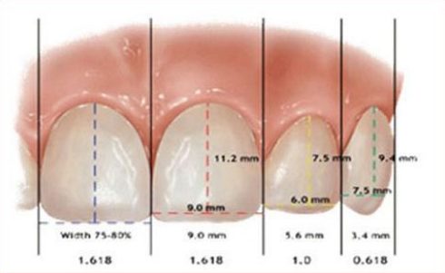 Một hàm răng đẹp dựa trên các yếu tố nào 7