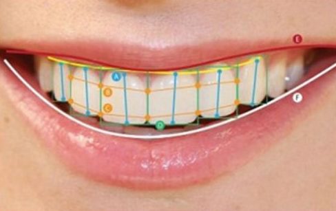 Một hàm răng đẹp dựa trên các yếu tố nào 4