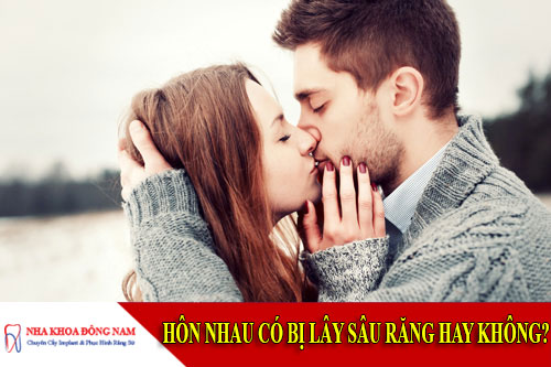 hôn nhau có bị lây sâu răng hay không?