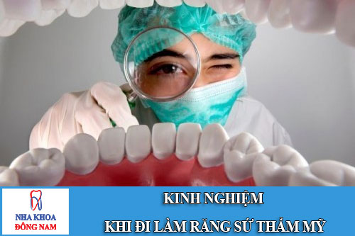 kinh nghiệm khi đi làm răng sứ thẩm mỹ