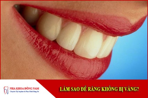 làm sao để răng không bị vàng