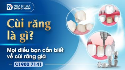 Mọi điều bạn cần biết về cùi răng