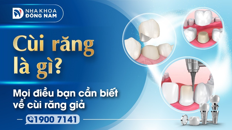 Mọi điều bạn cần biết về cùi răng