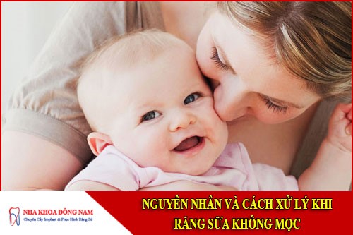 nguyên nhân và cách xử lý khi răng sữa không mọc