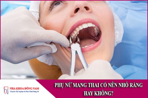 phụ nữ mang thai có nên nhổ răng hay không