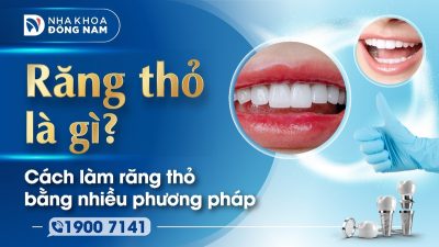 Răng thỏ là gì và cách làm răng thỏ bằng nhiều phương pháp