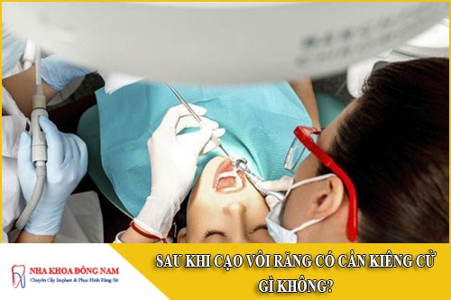 sau khi cạo vôi răng có cần kiêng cử gì không
