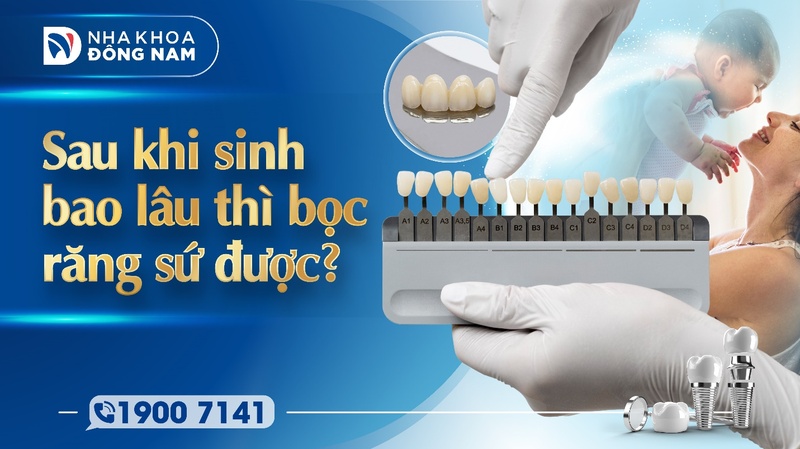 Sau khi sinh bao lâu thì bọc răng sứ được