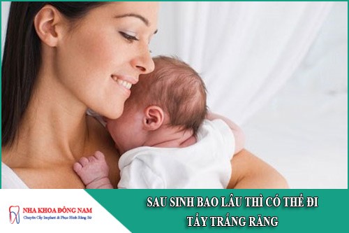 sau sinh bao lâu thì có thể đi tẩy trắng răng