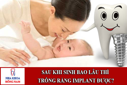 sau khi sinh bao lâu thì trồng răng implant được