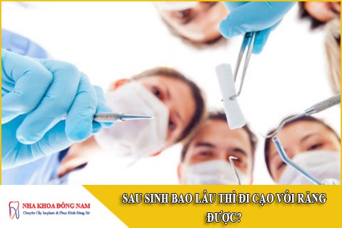 sau sinh bao lâu thì đi cạo vôi răng được