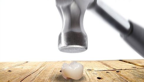 so sánh răng sứ kim loại và răng toàn sứ 5