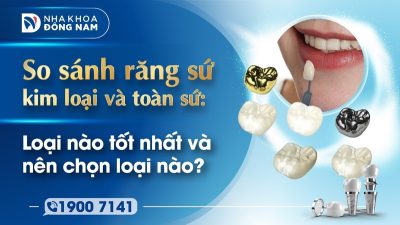 So sánh răng sứ kim loại và răng toàn sứ? Loại nào tốt nhất và nên chọn loại nào?