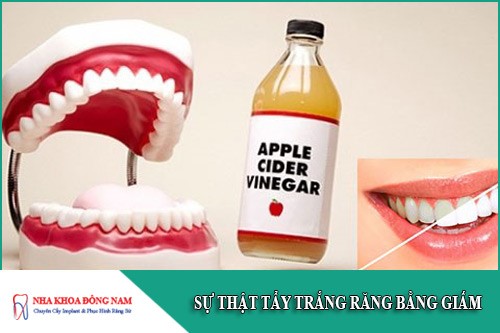 sự thật tẩy trắng răng bằng giấm