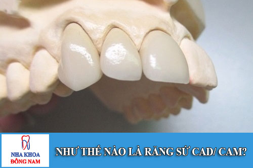 như thế nào là răng sứ cad/ cam