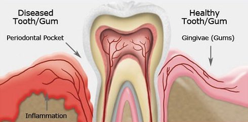 top 10 các vấn đề răng miệng thường gặp 3