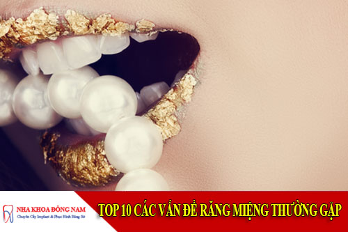 top 10 các vấn đề răng miệng thường gặp