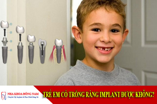 trẻ em có trồng răng implant được không
