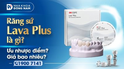 Ưu nhược điểm răng sứ Lava Plus