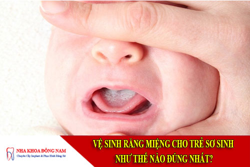 Vệ sinh răng miệng cho trẻ sơ sinh