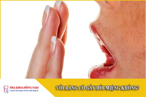 vôi răng có gây hôi miệng không