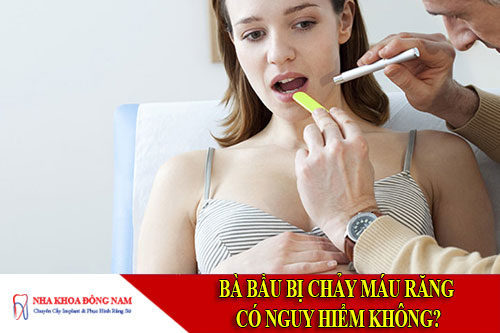 bà bầu bị chảy máu răng có nguy hiểm không
