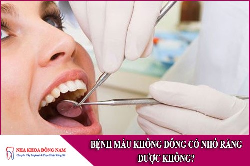 bệnh máu không đông có nhổ răng được không