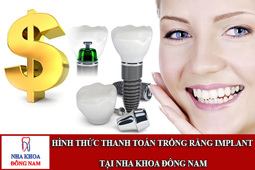 hình thức thanh toán trồng răng implant tại nha khoa đông nam