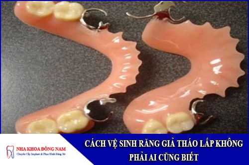 cách vệ sinh răng giả tháo lắp không phải ai cũng biết