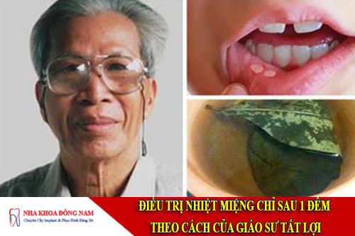 điều trị nhiệt miệng chỉ sau 1 đêm theo cách của giáo sư tất lợi