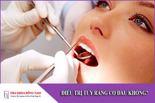 điều trị tủy răng có đau không