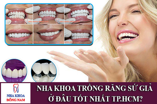 nha khoa trồng răng sứ giả ở đâu tốt nhất tp.hcm?