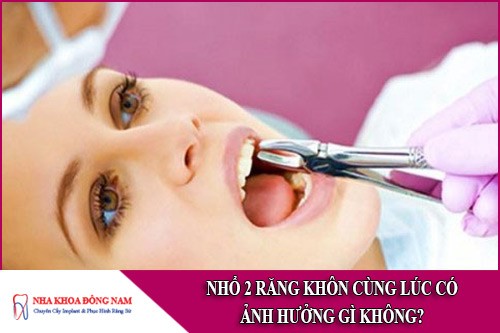 nhổ 2 răng khôn cùng lúc có ảnh hưởng gì không