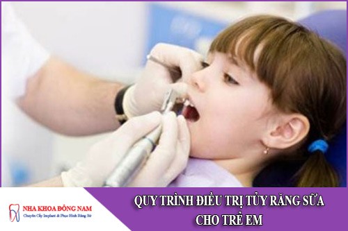 quy trình điều trị tủy răng sữa cho trẻ em