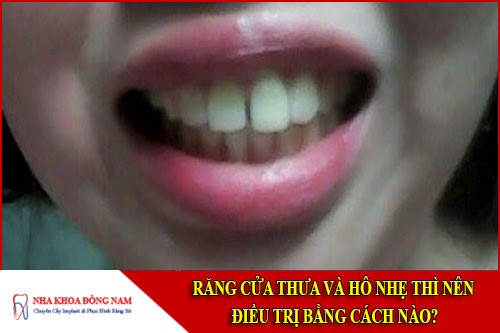 răng cửa thưa và hô nhẹ thì nên điều trị bằng cách nào