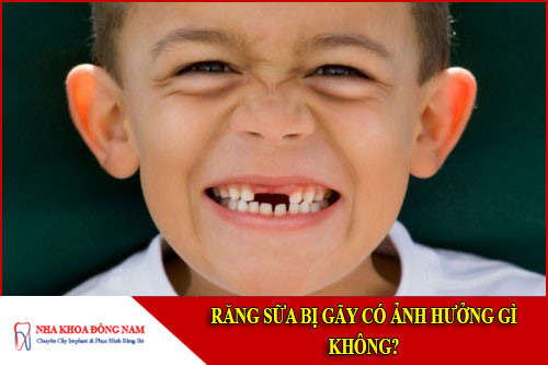 răng sữa bị gãy có ảnh hưởng gì không