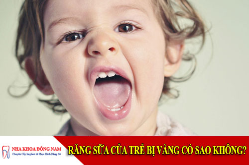 răng sữa của trẻ bị vàng có sao không