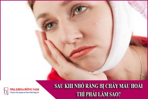 sau khi nhổ răng bị chảy máu hoài thì phải làm sao