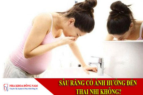 sâu răng có ảnh hưởng đến thai nhi không