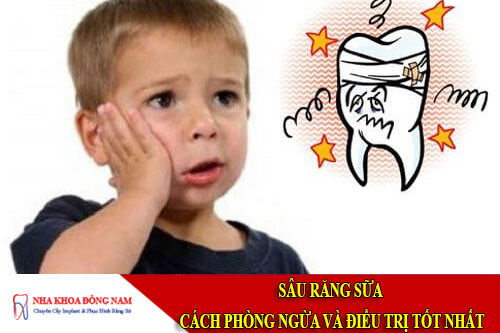 sâu răng sữa - cách phòng ngừa và điều trị tốt nhất