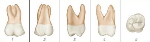 số thứ tự của các răng trên hàm răng 12
