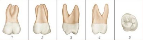 số thứ tự của các răng trên hàm răng 13