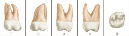 số thứ tự của các răng trên hàm răng 14